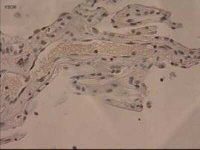 Immunohistochemistry: IL-3 Antibody (OTI3B11) - Azide and BSA Free [NBP2-71023]