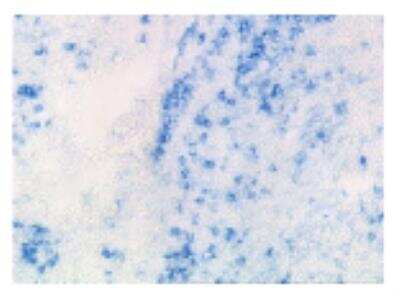 Immunohistochemistry: IL-3R alpha/CD123 Antibody (107D2.08) [DDX0300P-100]