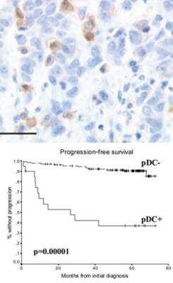 Immunohistochemistry-Paraffin: IL-3R alpha/CD123 Antibody (107D2.08) [DDX0300P-100]