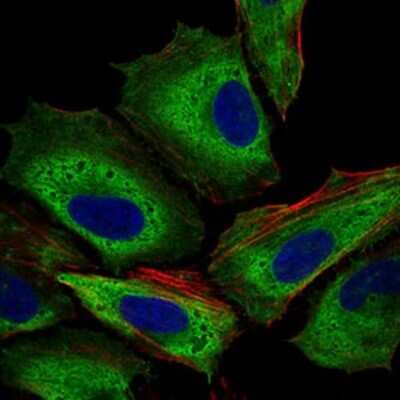 Immunocytochemistry/ Immunofluorescence: IL-3R alpha/CD123 Antibody (8E11C5) - BSA Free [NBP2-37354]
