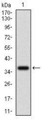 Western Blot: IL-3R alpha/CD123 Antibody (8E11C5)BSA Free [NBP2-37354]