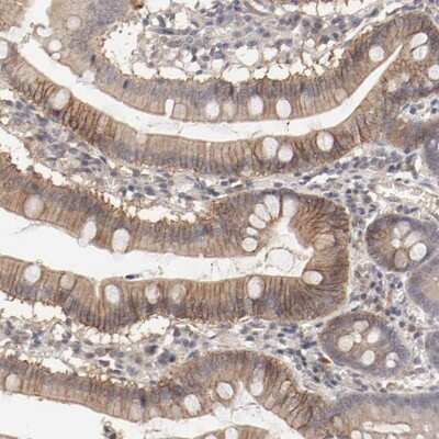 Immunohistochemistry-Paraffin: IL-3R alpha/CD123 Antibody [NBP1-86549]