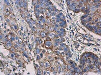 Immunohistochemistry-Paraffin: IL-3R alpha/CD123 Antibody [NBP2-16953]