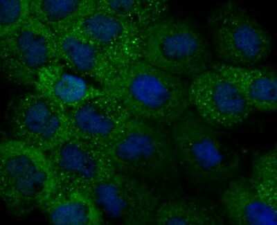 Immunocytochemistry/ Immunofluorescence: IL-31 Antibody (8-C3) [NBP2-80396]