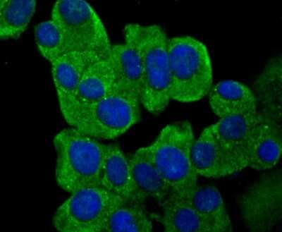 Immunocytochemistry/ Immunofluorescence: IL-31 Antibody (8-C3) [NBP2-80396]