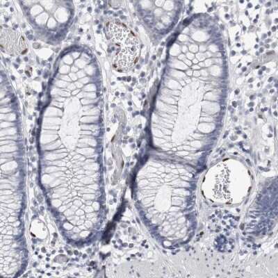 Immunohistochemistry-Paraffin: IL-33 Antibody [NBP1-86702]