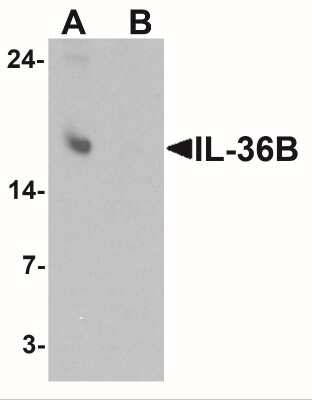 Western Blot: IL-36 beta/IL-1F8 AntibodyBSA Free [NBP2-41239]