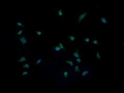 Immunocytochemistry/ Immunofluorescence: IL-36 gamma/IL-1F9 Antibody (OTI2F4) [NBP2-45749]