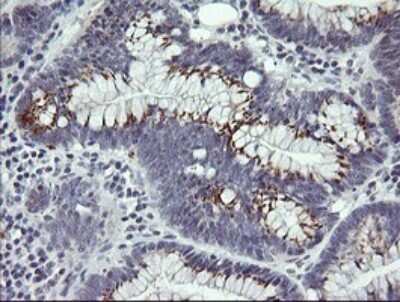 Immunohistochemistry: IL-36 gamma/IL-1F9 Antibody (OTI2F4) [NBP2-45749]