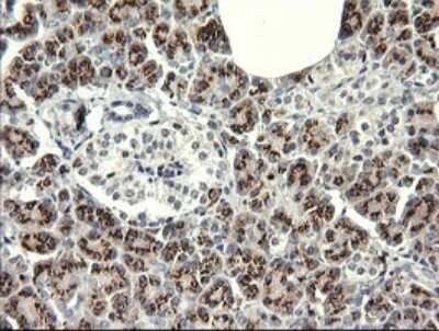 Immunohistochemistry: IL-36 gamma/IL-1F9 Antibody (OTI2F4) [NBP2-45749]