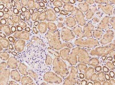 Immunohistochemistry-Paraffin: IL-40 Antibody [NBP3-05944]