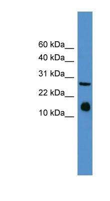 Western Blot: IL-5 Antibody [NBP1-69163]