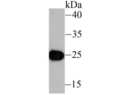 Western Blot: IL-6 Antibody (1-6) [NBP2-89149]