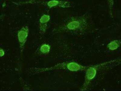 Immunocytochemistry/ Immunofluorescence: IL-6 Antibody (OTI3G9) [NBP1-47810]