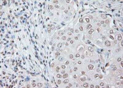 Immunohistochemistry-Paraffin: IL-6 Antibody (OTI3G9) - Azide and BSA Free [NBP2-71027]
