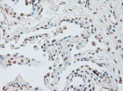 Immunohistochemistry-Paraffin: IL-6 Antibody (OTI3G9) - Azide and BSA Free [NBP2-71027]
