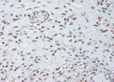 Immunohistochemistry-Paraffin: IL-6 Antibody (OTI3G9) - Azide and BSA Free [NBP2-71027]