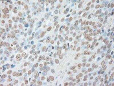Immunohistochemistry-Paraffin: IL-6 Antibody (OTI3G9) - Azide and BSA Free [NBP2-71027]
