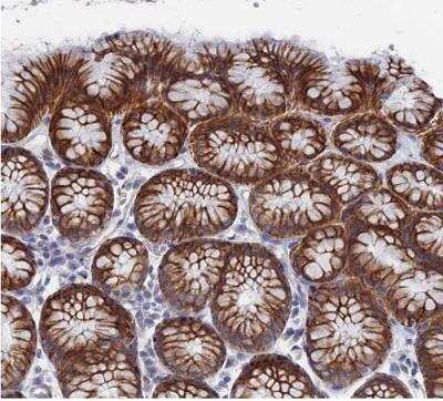 Immunohistochemistry-Paraffin: IL-7 Antibody [NBP1-83111]