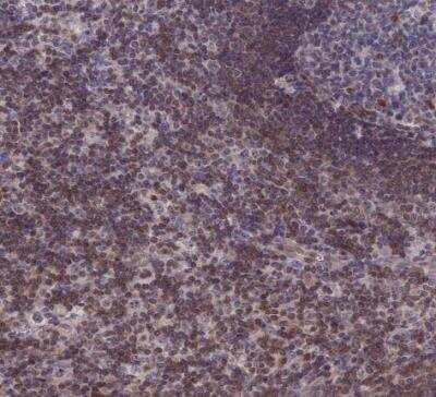 Immunohistochemistry-Paraffin: IL-7 Antibody [NBP1-83111]