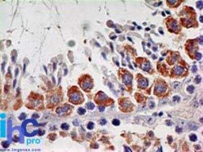 Immunohistochemistry-Paraffin: IL-7R alpha/CD127 Antibody (73N8F2) [NBP2-25249]