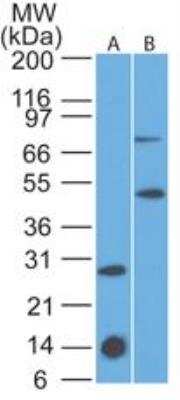 Western Blot: IL-7R alpha/CD127 Antibody (73N8F2) [NBP2-25249]