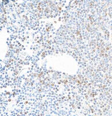 Immunohistochemistry: IL-7R alpha/CD127 Antibody (BLR177J) [NBP3-14749]
