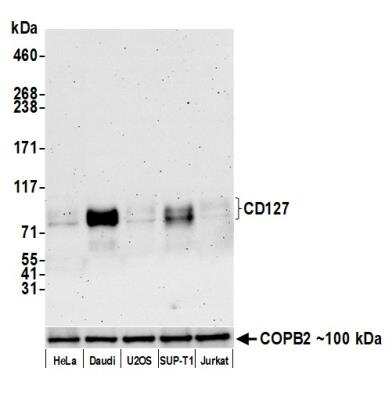 Western Blot: IL-7R alpha/CD127 Antibody (BLR177J) [NBP3-14749]