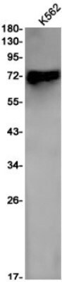 Western Blot: IL-7R alpha/CD127 Antibody (S08-5I2) [NBP3-20032]