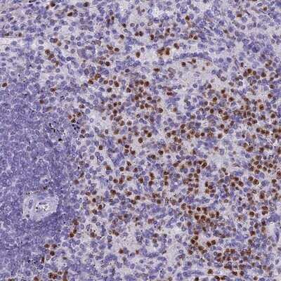 Immunohistochemistry-Paraffin: IL-17B Antibody [NBP1-83113]