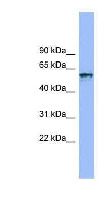Western Blot: IL18R1 Antibody [NBP1-59720]