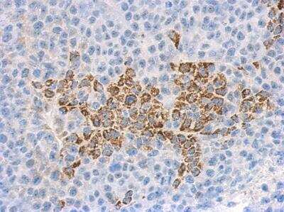 Immunohistochemistry-Paraffin: IL-36 gamma/IL-1F9 Antibody [NBP1-31185]