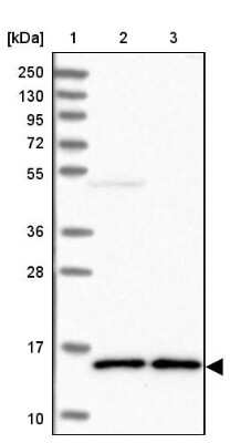 Western Blot: SF20/MYDGF Antibody [NBP2-48856]