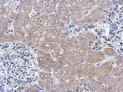 Immunohistochemistry-Paraffin: IL-27 Antibody [NBP2-16951]