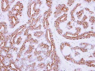 Immunohistochemistry-Paraffin: IL-3R alpha/CD123 Antibody [NBP2-16953]