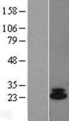 Western Blot: IL-6 Overexpression Lysate [NBL1-11962]