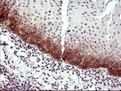 Immunohistochemistry: IL6R Antibody (OTI2F4) - Azide and BSA Free [NBP2-71029]