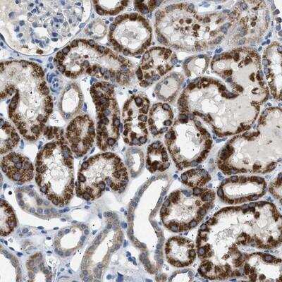 Immunohistochemistry-Paraffin: ILDR1 Antibody [NBP1-85236]