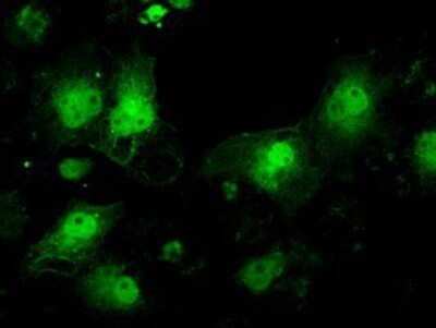 Immunocytochemistry/ Immunofluorescence: ILF2 Antibody (OTI6F1) - Azide and BSA Free [NBP2-71036]