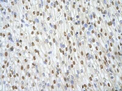 Immunohistochemistry: ILF3 Antibody [NBP1-58226]