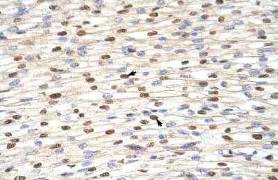 Immunohistochemistry: ILF3 Antibody [NBP1-58226]