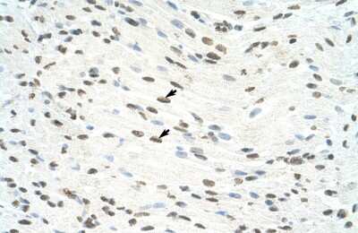 Immunohistochemistry-Paraffin: ILF3 Antibody [NBP1-58225]