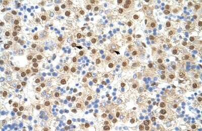 Immunohistochemistry-Paraffin: ILF3 Antibody [NBP1-58226]