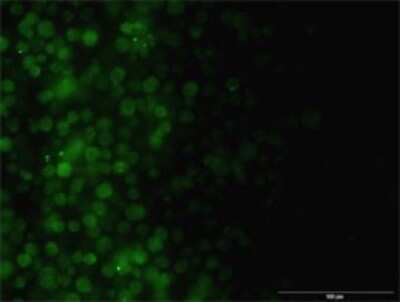 Immunocytochemistry/ Immunofluorescence: ILK Antibody (4F10) [H00003611-M01]
