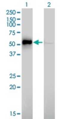 Western Blot: ILK Antibody (4F10) [H00003611-M01]