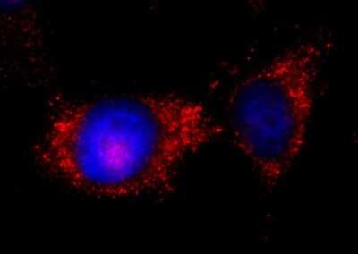 Immunocytochemistry/ Immunofluorescence: ILK Antibody [NB100-60451]