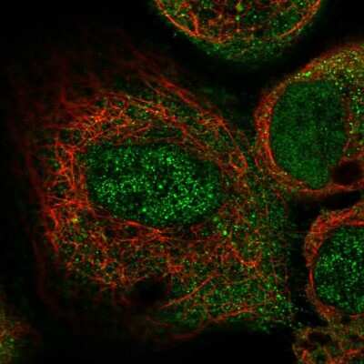 Immunocytochemistry/ Immunofluorescence: ILK Antibody [NBP2-55514]