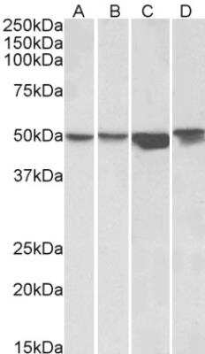 Western Blot: ILK Antibody [NB100-809]