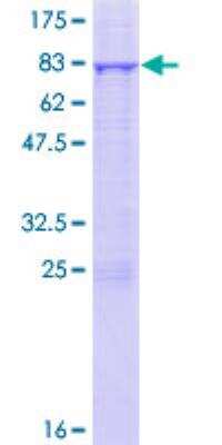 SDS-PAGE: Recombinant Human ILK GST (N-Term) Protein [H00003611-P01]