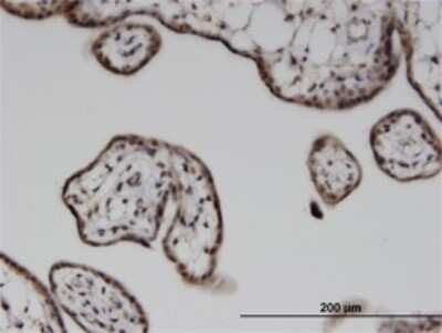 Immunohistochemistry-Paraffin: ILKAP/PP2C delta Antibody (3B5) [H00080895-M02]